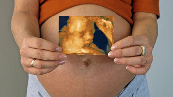 Frau hält Bild des ungeborenen Kindes vor ihren Babybauch