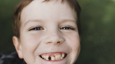 Die erste Zahnlücke: Tipps vom Zahnarzt rund um das Thema Kinder und Zähne